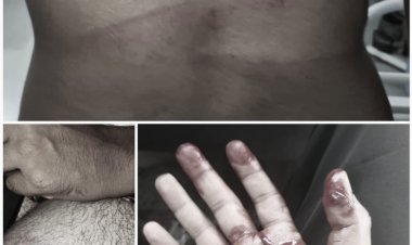 गांव में छोड़ने का कहकर कैम्पर में बिठाया, फिर गम्भीर मारपीट करने का आरोप, मामला दर्ज